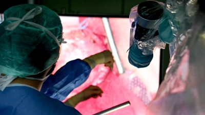 Optimale Sichtverhältnisse für Neurochirurgen: Die Kamera des Exoskops (im Bild rechts) und der große Bildschirm ermöglichen einen exakten Blick auf das Operationsfeld.  (Foto: Klinikum Bayreuth )