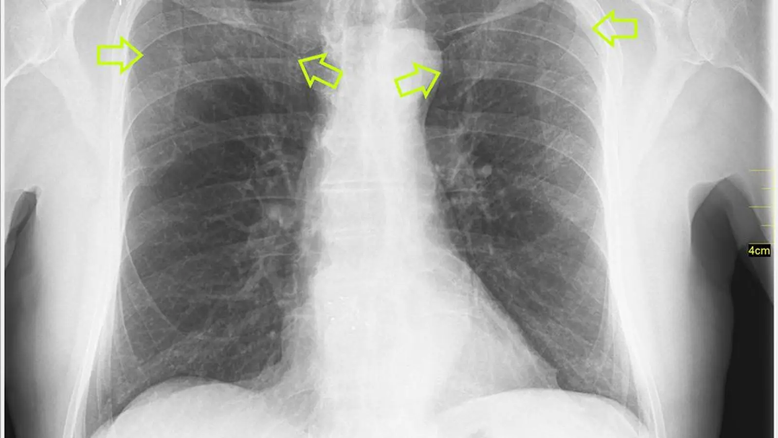 Ratgeber Gesundheit: Radiologische Diagnostik bei COVID-19 (Foto: inBayreuth.de)