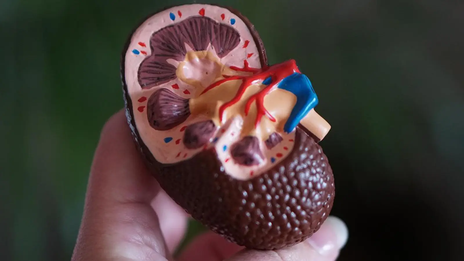 Weltnierentag am 9. März 2023. (Foto: Robina Weermeijer)